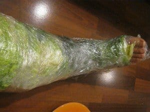 cabbage leaf poultice